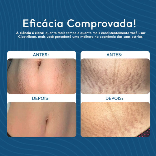 Creme Hidratante Anti Estrias Regenerador Dérmico da Cicatribem 150g