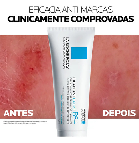 Creme Multirreparador Calmante Cicaplast Baume B5+ Para Todos Os Tipos De Pele Com 40ml La Roche Posay