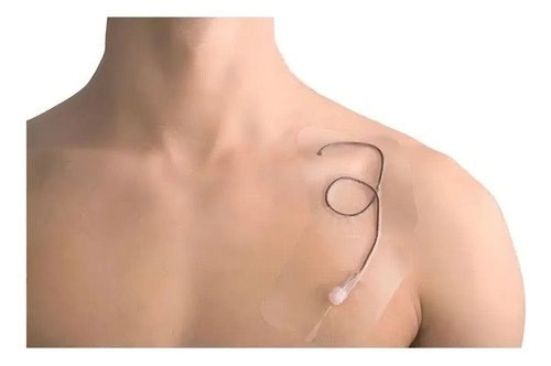 Curativo Transparente Rolo Filme 10cm X 10 Metros Pharmafix