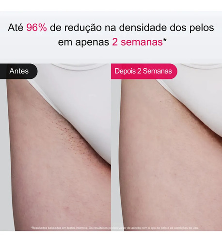 Depilador a Laser IPL Ulike Air 10 Sem Dor com Resfriamento em Safira, 26J, Luz Dupla, SkinSensor, Modo SHR, para Corpo, Rosto e Barba Masculina, Bivolt, Unissex