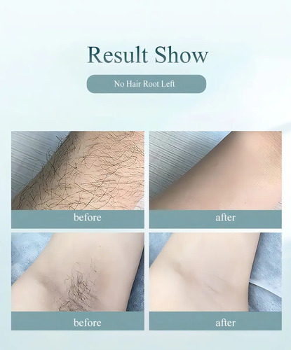 Depilador A Laser Luz Pulsada IPL Basike Sensacao Gelo Indolor Depilacao Definitiva 1 Milhao Disparos 9 Niveis Rosto Corpo aparelho depilacao feminino depilação a laser laser depilacao depilacao intim