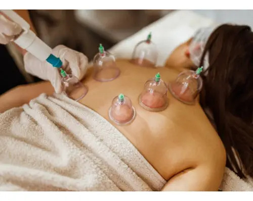 Kit Ventosas Com Bomba Ventosa Terapia Massoterapia Massagem