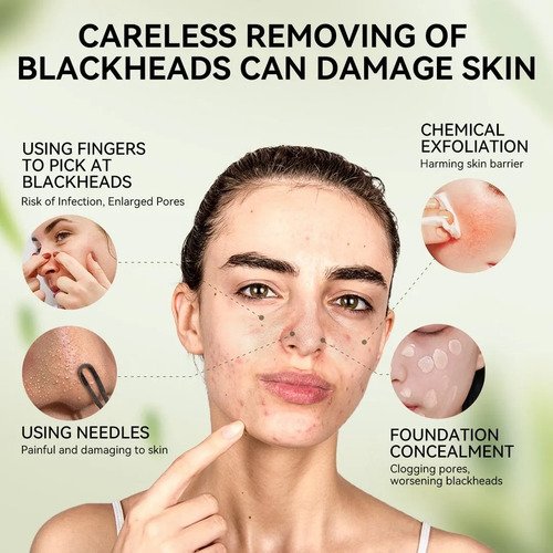 Lanbena 3.0 Máscara Facial Removedora De Cravos 30g Charcoal