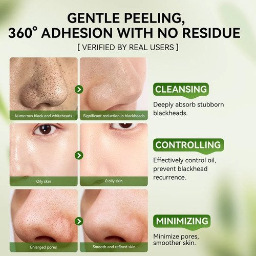 Lanbena 3.0 Máscara Facial Removedora De Cravos 30g Charcoal