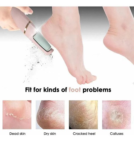 Lixador De Pé Elétrico Lixa Esfolia Elimina Calos Portátil