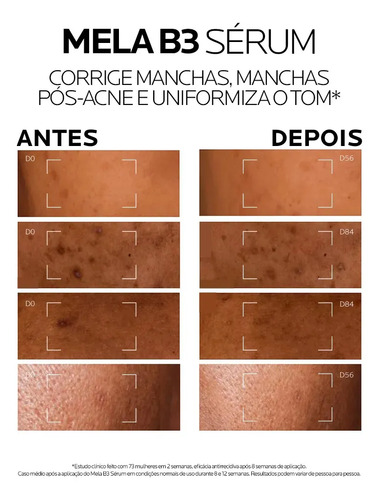 Sérum Antimanchas com Melasyl e Niacinamida para Todos os Tipos de Pele que Corrige Manchas Persistentes, Unifica o Tom e Ilumina, sem Perfume, Mela B3 La Roche‑Posay 15ml