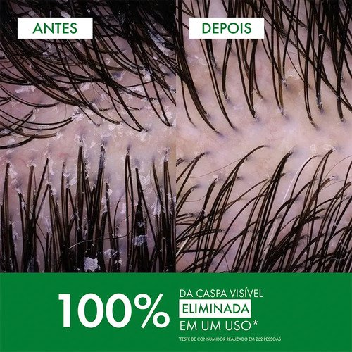 Shampoo Anticaspa Cabelos Normais a Oleosos, Dercos DS Vichy, 300g